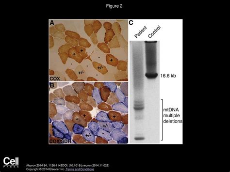 Mitochondrial DNA Impacting Central And Peripheral Nervous Systems