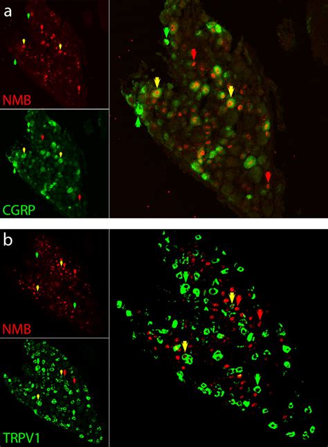 A Nociceptive Signaling Role For Neuromedin B Journal Of Neuroscience