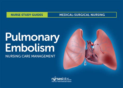 Pulmonary Embolism System Disorder Template Pulmonary Embolism Rule