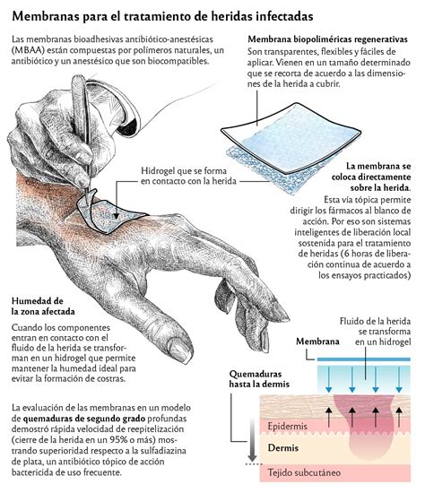 Desarrollan Membranas Regenerativas Para El Tratamiento De Heridas