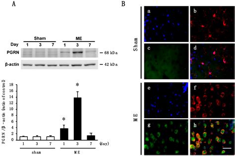 Ijms Free Full Text Involvement Of Progranulin And Granulin