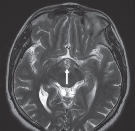 Multisequential Multiplanar Magnetic Resonance Images Of The Brain With