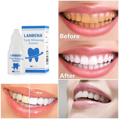 Ml Liquid Tooth Whitening Essence Serum Removes Oral Hygiene Cleaning