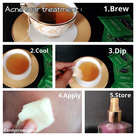 Green Tea for Acne Scars - Candy Crow