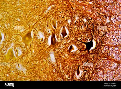 Spinal Cord Cross Section Showing Neurones And Glia Cells Light