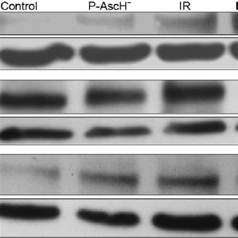 Changes In Nuclear Factor Erythroid 2 Related Factor 2 Nrf2