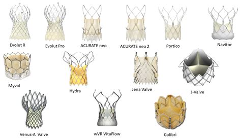 Jcm Free Full Text An Update On New Generation Transcatheter Aortic