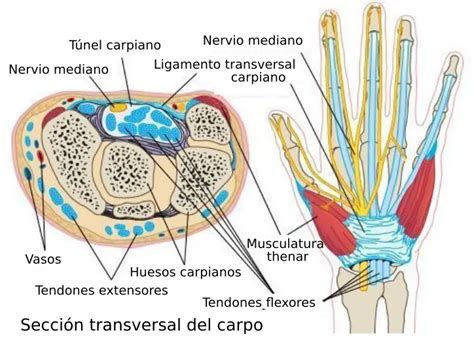 Cirugía endoscópica ultraselectiva del túnel carpiano