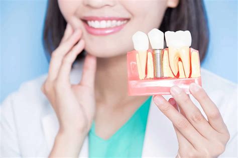 Five Reasons To Invest In Dental Implants To Replace Lost Teeth