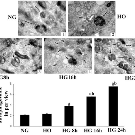 Effect Of High Glucose On Autophagy And Apoptosis In Hk Cells