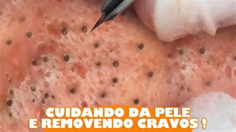 APRENDA A FAZER LIMPEZA DE PELE PASSO A PASSO CLIQUE AQUI E APRENDA