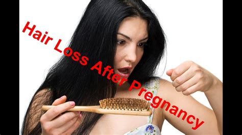 Hair Loss After Pregnancy Solutions Youtube