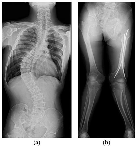 Endocrines Free Full Text The Possible Outcomes Of Poor Adherence To Conventional Treatment