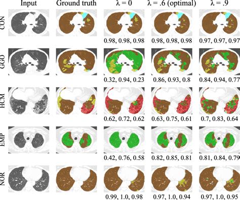 Examples Of Segmentation Results For Fully Annotated Samples The Three