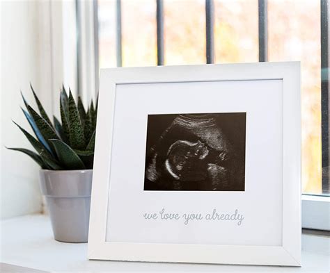 Kate Milo Love At First Sight Ultrasound Picture Frame White