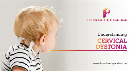 Understanding Cervical Dystonia - Dr. Prashanth Pandian