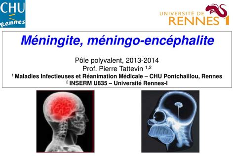 PPT Méningite méningo encéphalite Pôle polyvalent 2013 2014 Prof