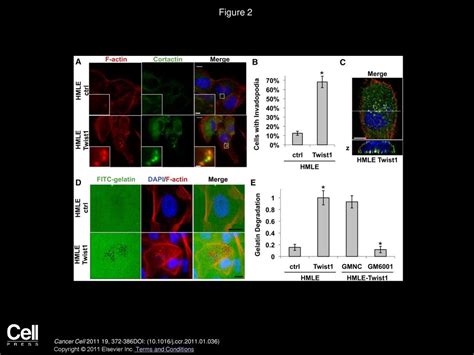 Twist Induced Invadopodia Formation Promotes Tumor Metastasis Ppt