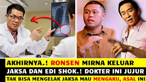 Akhirnya Ronsen Mirna Muncul Dokter Ini Skakmat Jaksa Dan Pak Edi