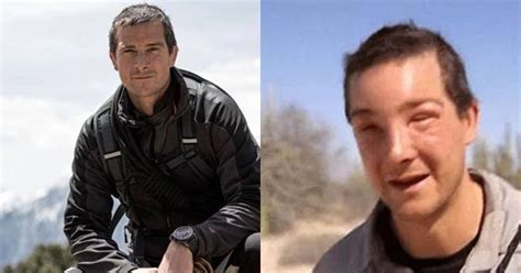 Bear Grylls Allergic To Bees:Wildlife Expert Bear Grylls Saved By Medics After Lethal Bee Sting