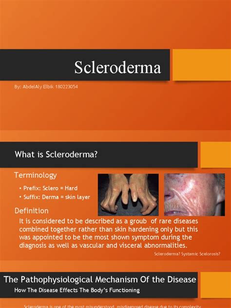 Scleroderma Pdf Epidemiology Medicine