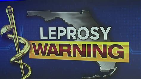 CDC Issues Warning In Florida Due To Rising Cases Of Leprosy YouTube