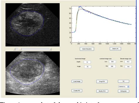 Figure 1 From Evaluation Of Adaptive Perfusion Models In Dynamic