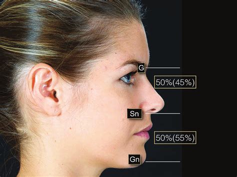 Prominent Glabella