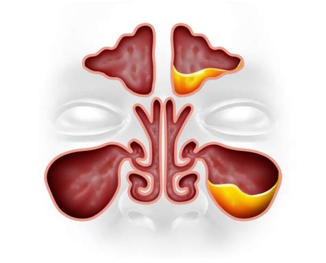 40+ Sphenoid Sinuses Stock Photos, Pictures & Royalty-Free Images - iStock