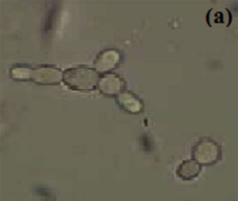 Effect Of Growth Media Ph And Temperature On Yeast To Hyphal Transition In Candida Albicans