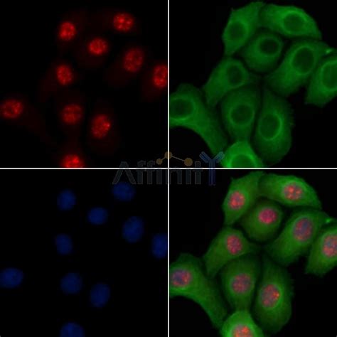 Phospho E Bp Ser Thr Antibody Affinity Biosciences Ltd