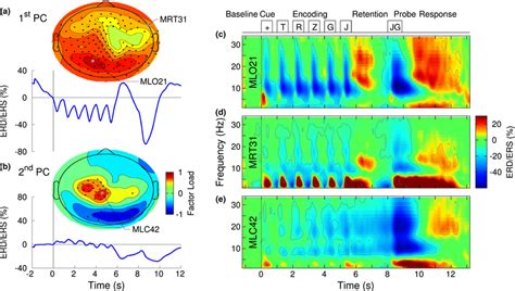 Overview Of The Erd Ers Time‐frequency Analysis A Time Course And