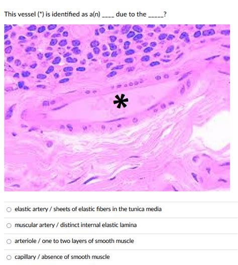 Muscular Artery Vs Elastic Artery Histology