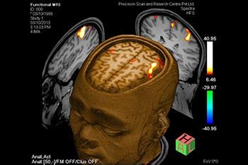 Functional MRI - Precision Scan