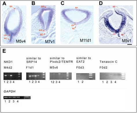 Verification Of The Differential Expression Of The Cdnas Excised From