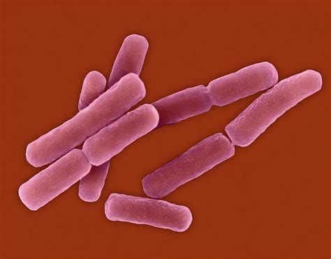 Bacillus Anthracis 8 Photograph By Science Photo Library Pixels