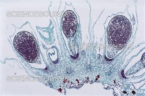 Photograph | Marchantia Sporophyte | Science Source Images