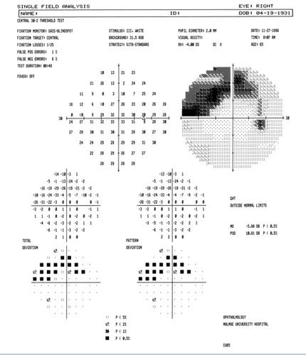 Clinical Eval 4 Visual Fields Flashcards Quizlet