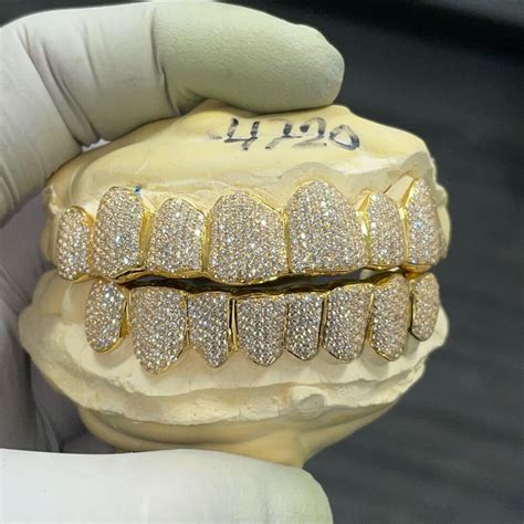 VVS Diamonds Fully Flooded Gold Grillz – Grillz Factory