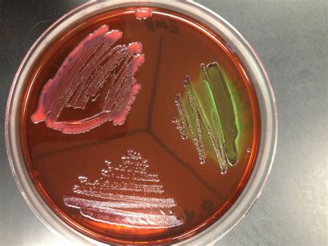 Microbiology Ch 6 Microbial Growth Flashcards Quizlet