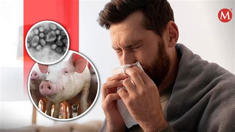 Gripe porcina Qué es y cuáles son los síntomas de la influenza H1N2