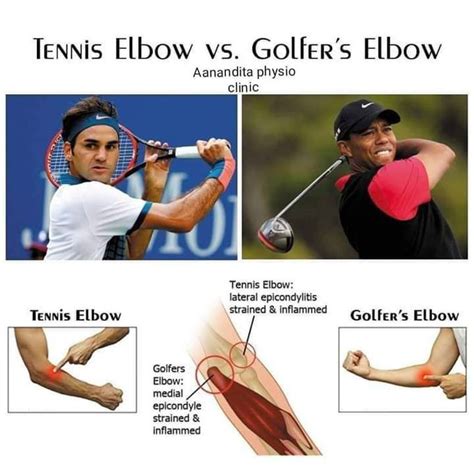 Tennis And Golfer S Elbow Medizzy