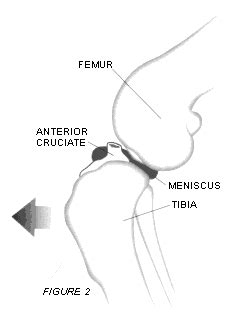 What is a Meniscus? What are the Function of Mensci in Dog Knee?