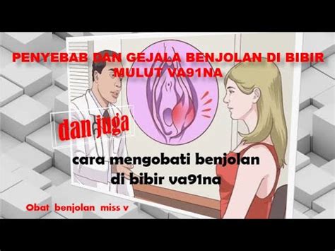 Penyebab Dan Gejala Benjolan Di Bibir Mulut Vagina Cara Mengobati