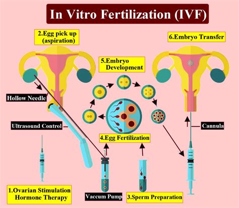 Suggest And Explain The Assisted Reproductive Techniques Which Will Help A Couple To Have