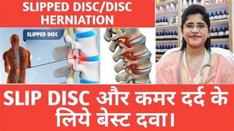 Slipped Disc Herniated DiscHomeopathic Medicine For Slip Disc