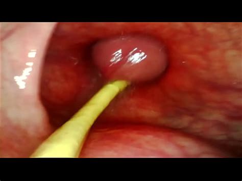 EXTREME ANAL POV CAMERA INSIDE HER ASSHOLE AS I POUND HER WITH MY BIG COCK AND CUM DEEP INSIDE