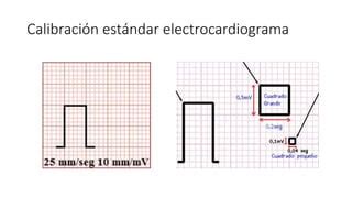 Generalidades De Electrocardiograma Basico PPT