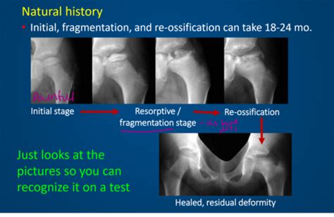 MSK Week 4 Flashcards Quizlet