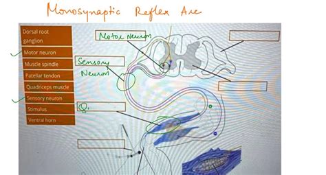 Solved Place The Following Events Of A Knee Jerk Reflex In Order